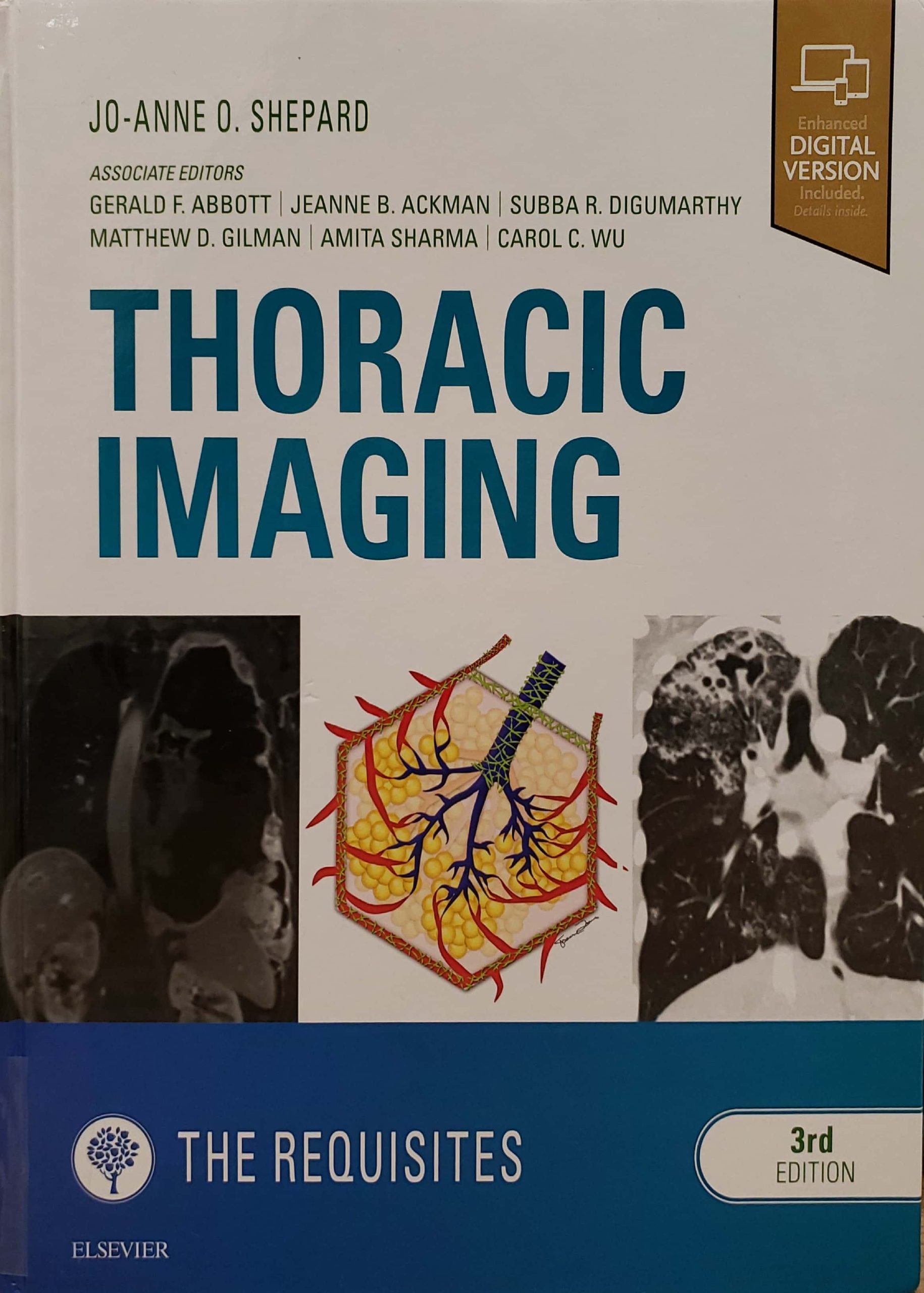 Thoracic Imaging